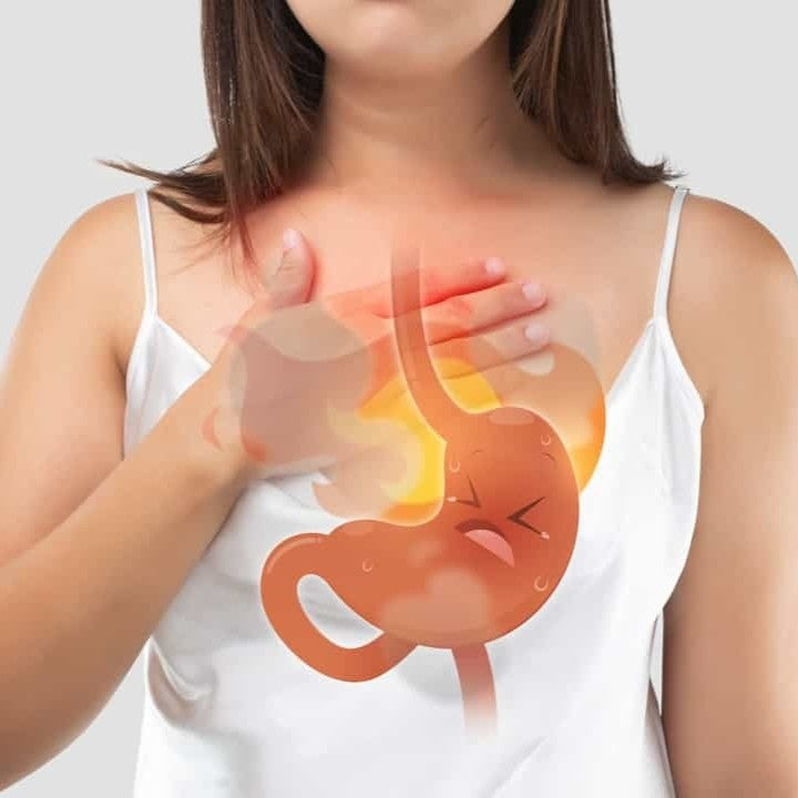 Heartburn — How Gut Imbalance Can Trigger Acid Reflux